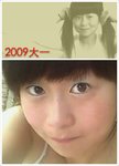 #整形变美#我已经行动 ——割了双眼皮