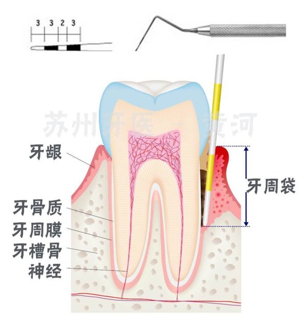 为健康投资: 从关爱口腔做起