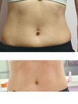  At the age of 40, how did I reduce the abdominal fat and develop the waistcoat line