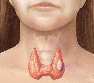 甲状腺的位置图片图片