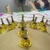 养生打卡day10艾灸