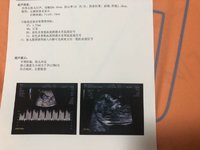 从生殖中心毕业了🎓