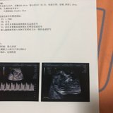 从生殖中心毕业了🎓
